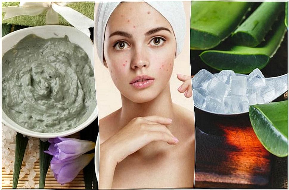 5 naturally occurring treatments for pimples on the face