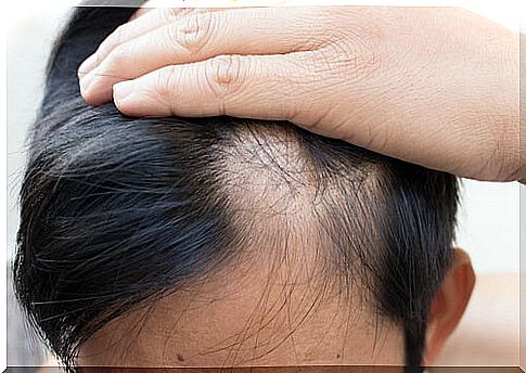 Include zinc in your diet to delay alopecia